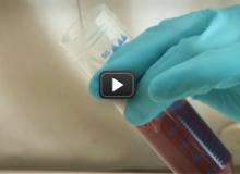 Looking for genes in the lab