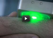 Skin cancer exposed