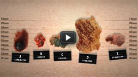 Els sospitosos poc habituals