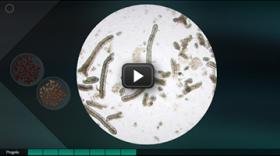 Investiga una cura para el cáncer colorrectal!