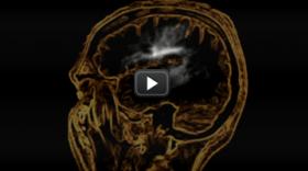 How does air pollution affect our brain?