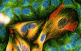 El càncer de pell al descobert